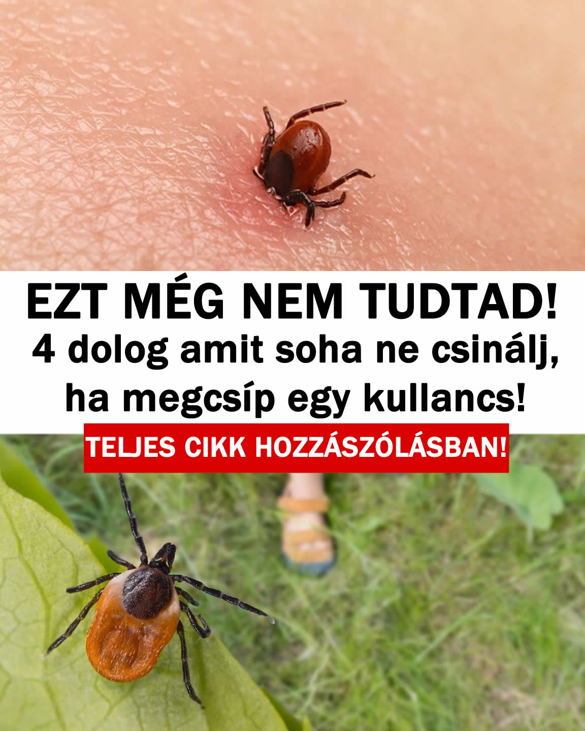 4 dolog amit soha ne csinálj, ha megcsíp egy kullancs!