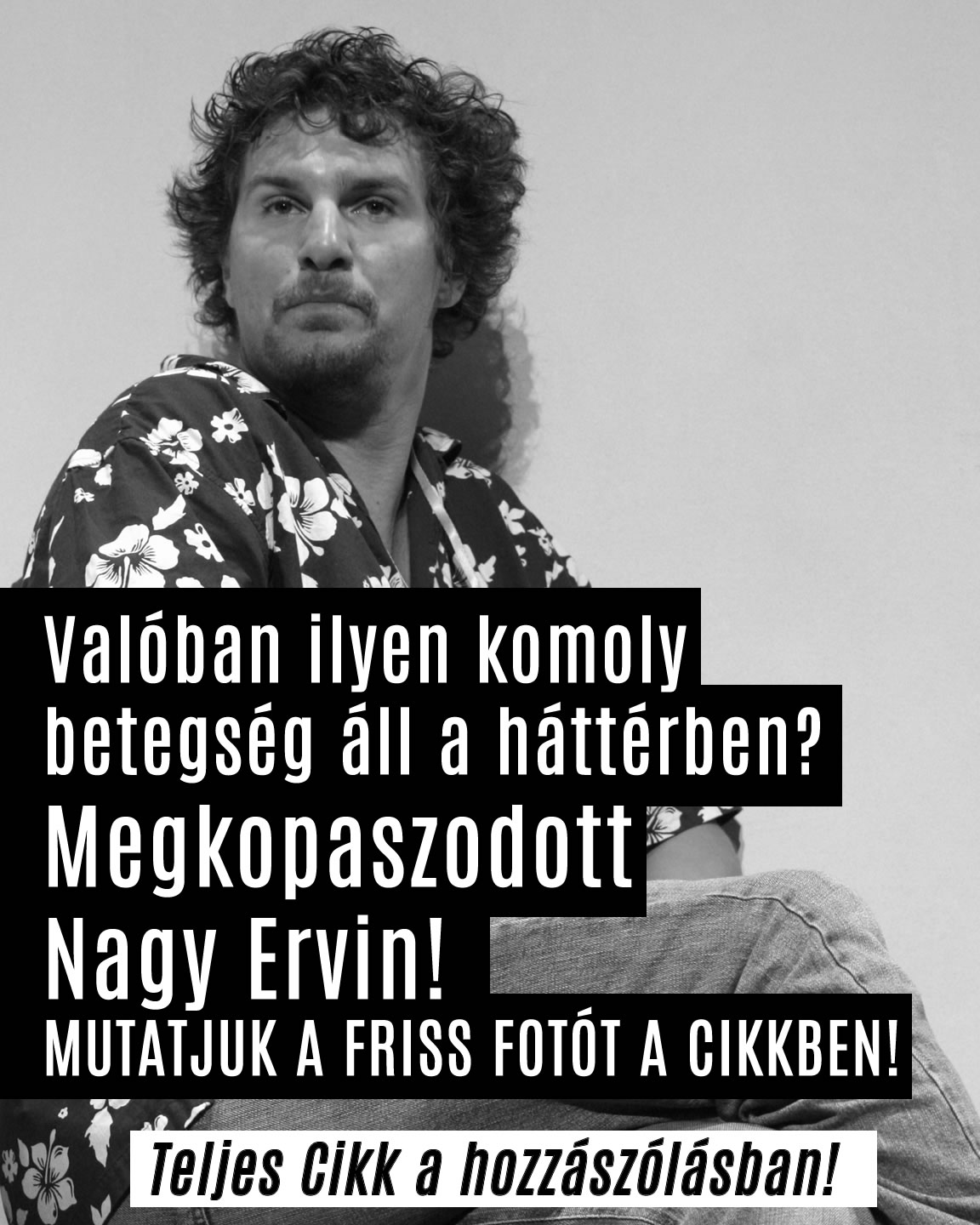 Megkopaszodott Nagy Ervin!