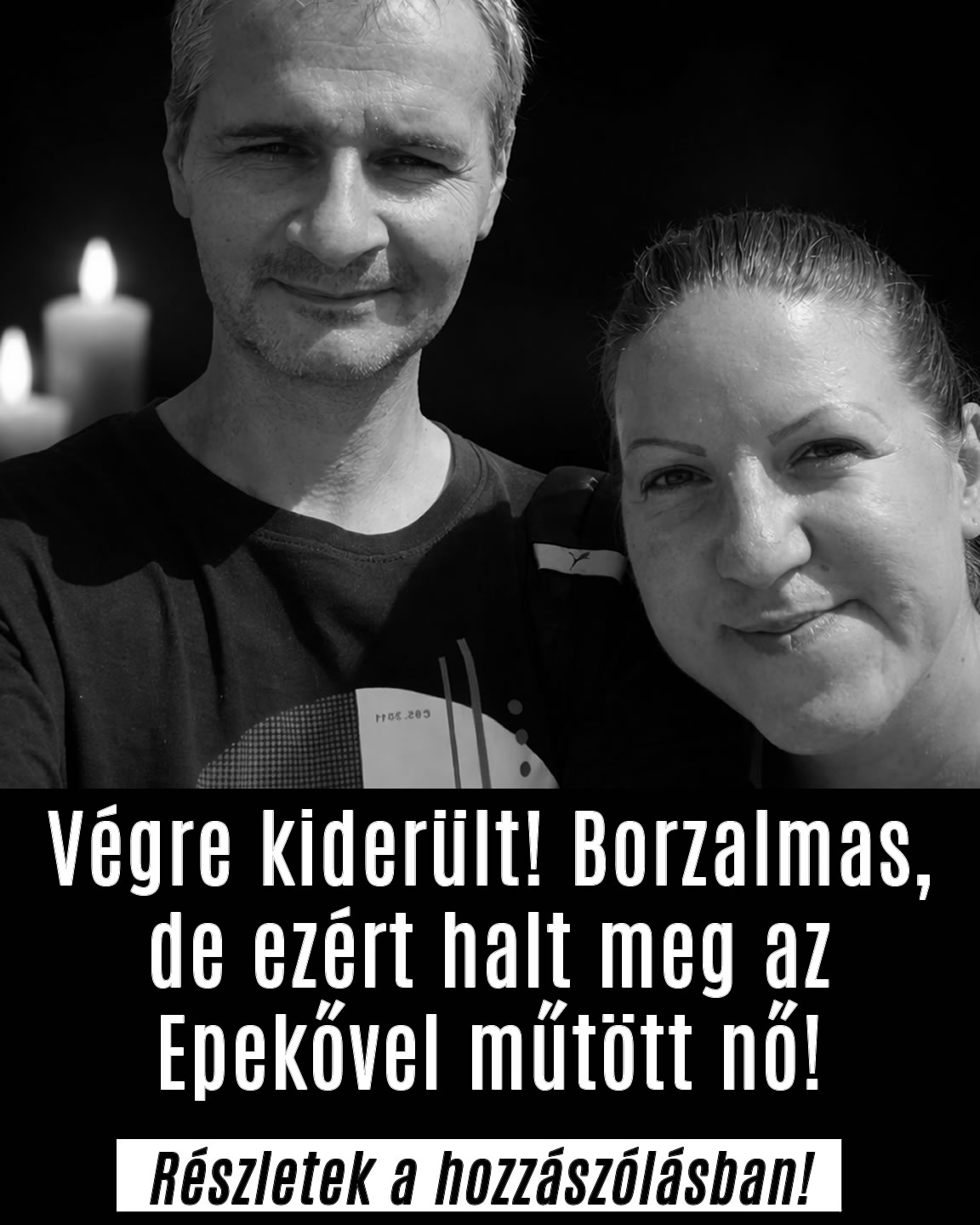 Ezért halt meg az Epekővel műtött nő!