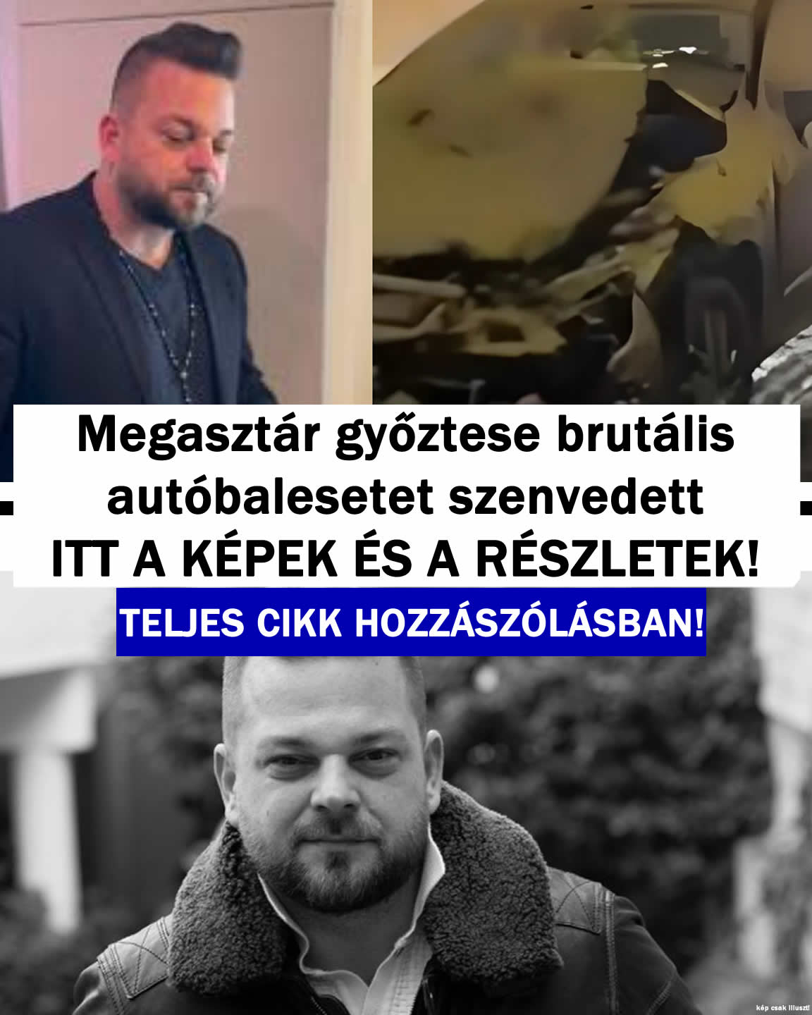 Megasztár győztese brutális autóbalesetet szenvedett