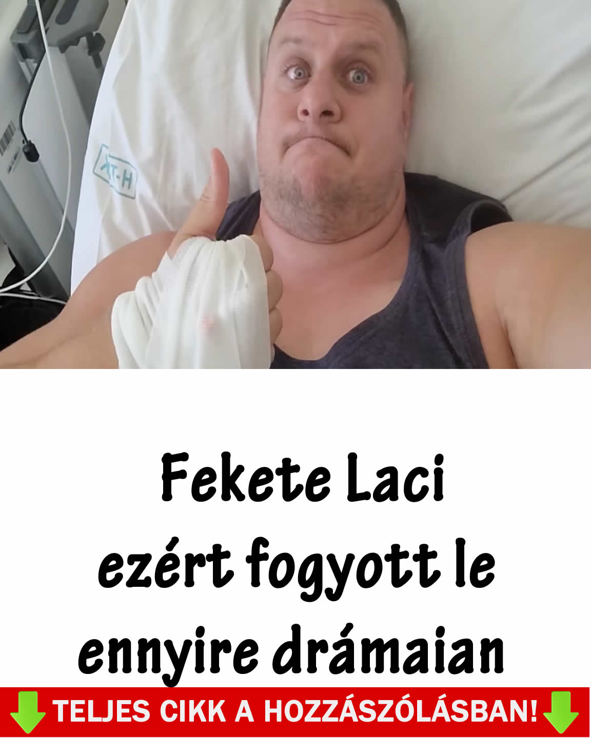 Fekete Laci ezért fogyott le ennyire drámaian