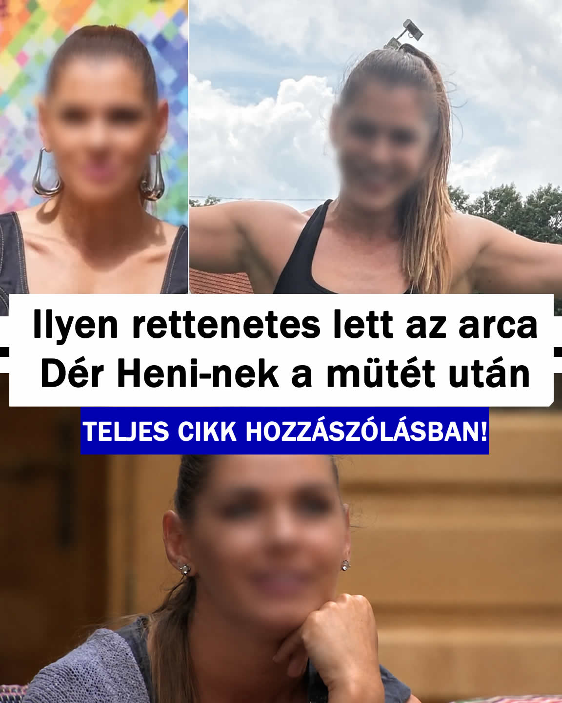 Mi történt Dér Heni arcával? Műtétje után