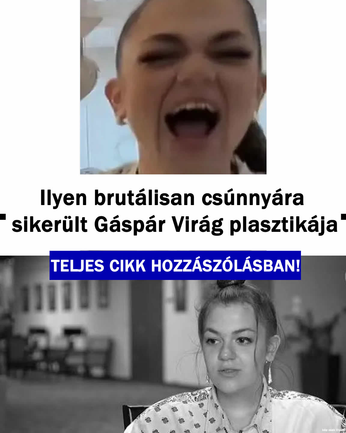 Ilyen brutálisan csúnyára sikerült Gáspár Virág plasztikája